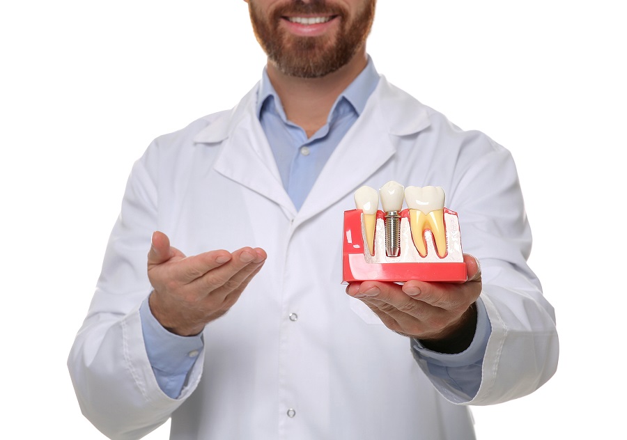 Why Dental Implants Are the Best Option for Missing Teeth