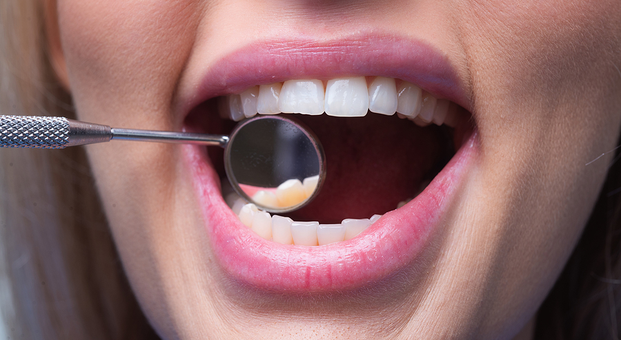 Transforming Smiles: How Dental Implants Strengthen Jawbone Health and Enhance Facial Aesthetics